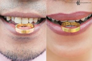 We bites our gold wedding ring